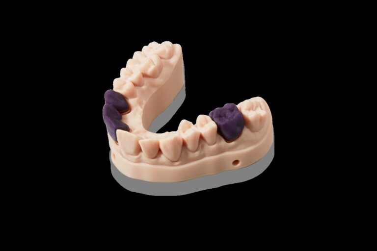 Patrones impresos en Castable Wax Resin listos para revestir y colar.