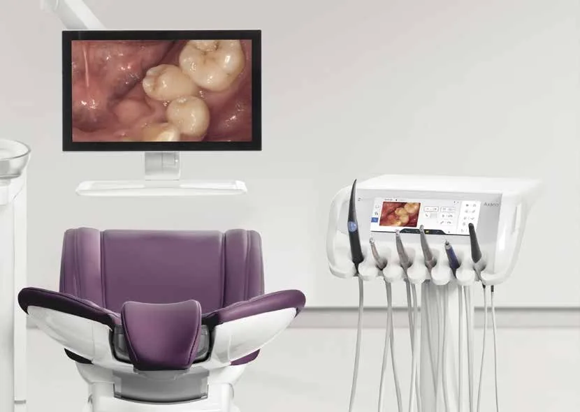 Monitor Sivision del Axano mostrando una imagen intraoral