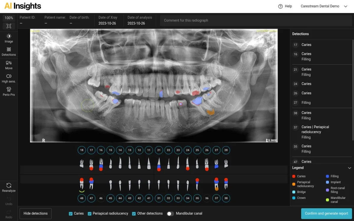 Pantalla de AI Insights con radiografía, odontograma y lista de detecciones