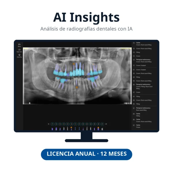AI Insights · Licencia anual de IA para radiografías dentales - SP Integra Canarias