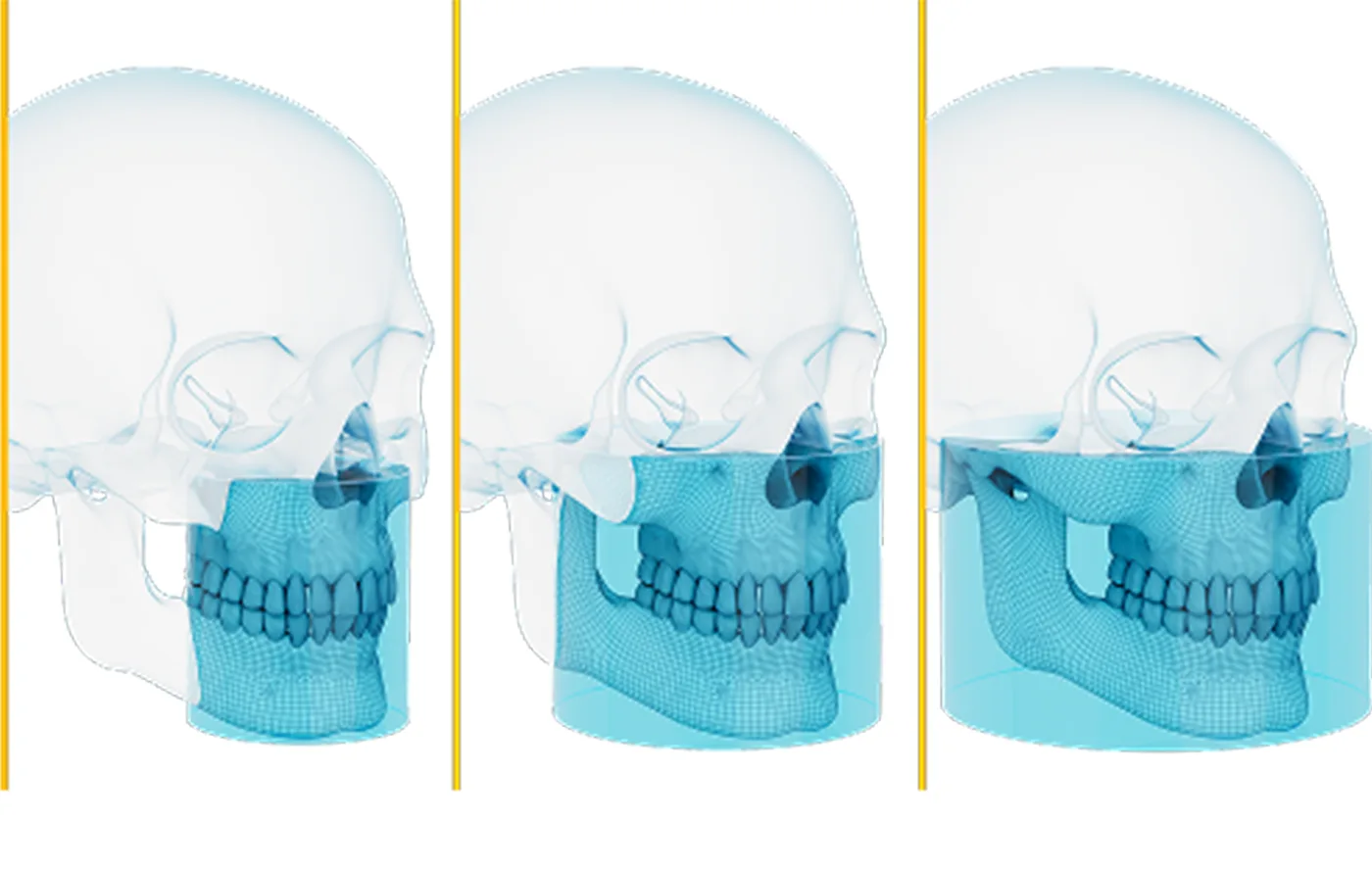 Las tres configuraciones del CS 8200 3D Advance: 8×9, 12×10 y 16×10 cm