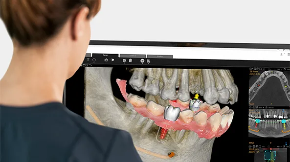 Software CS 3D Imaging