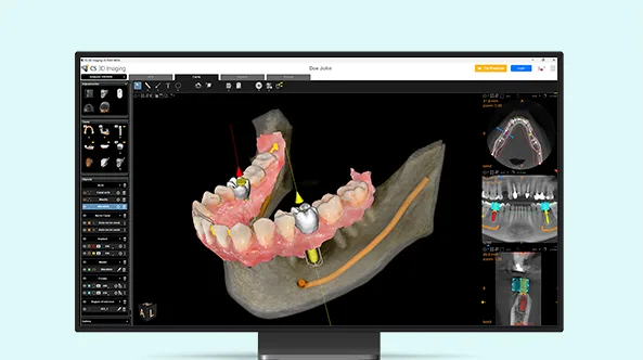 CS 3D Imaging Premium