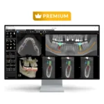 Licencia CS 3D Imaging Premium de Carestream con pantalla de planificación de implantes