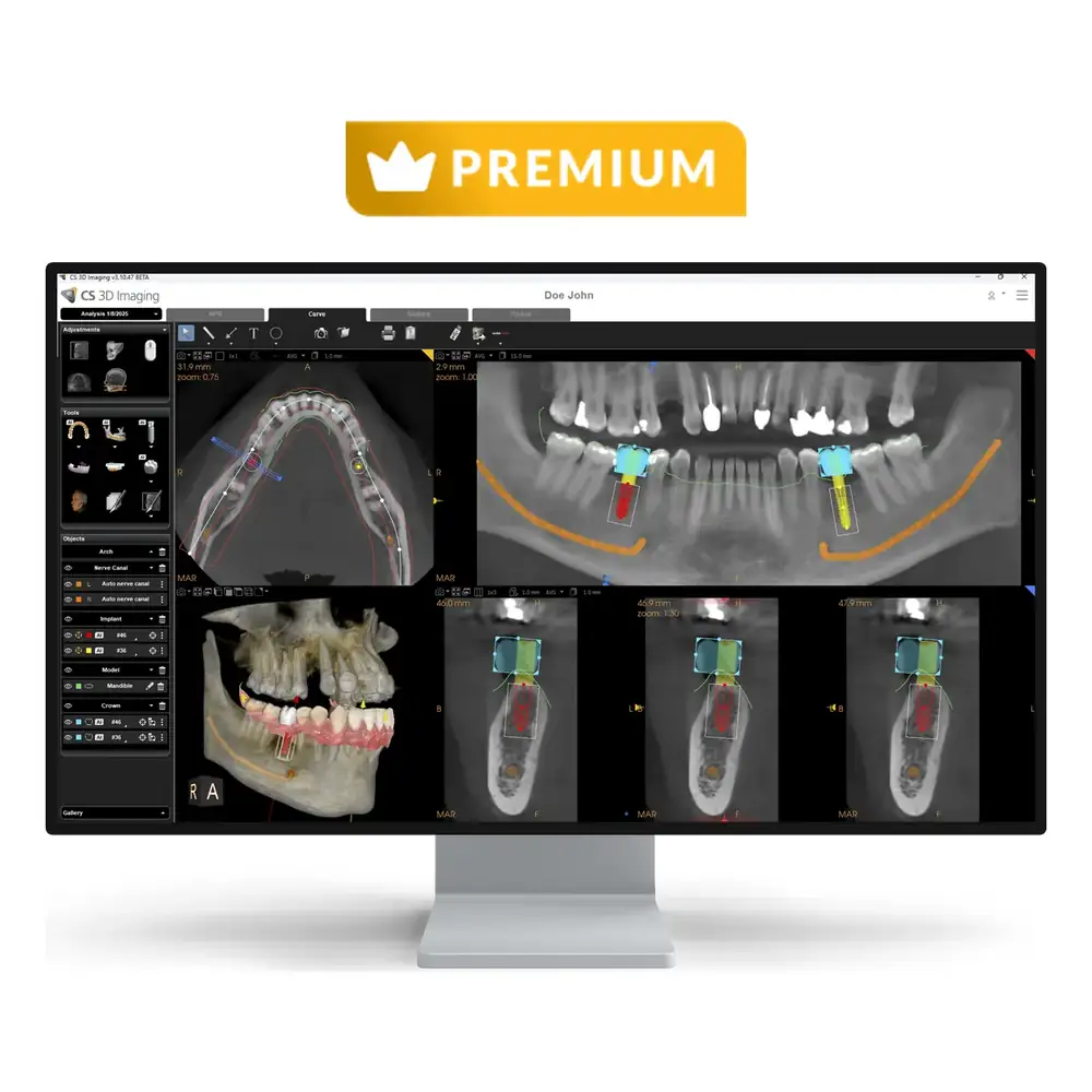 Licencia CS 3D Imaging Premium de Carestream con pantalla de planificación de implantes