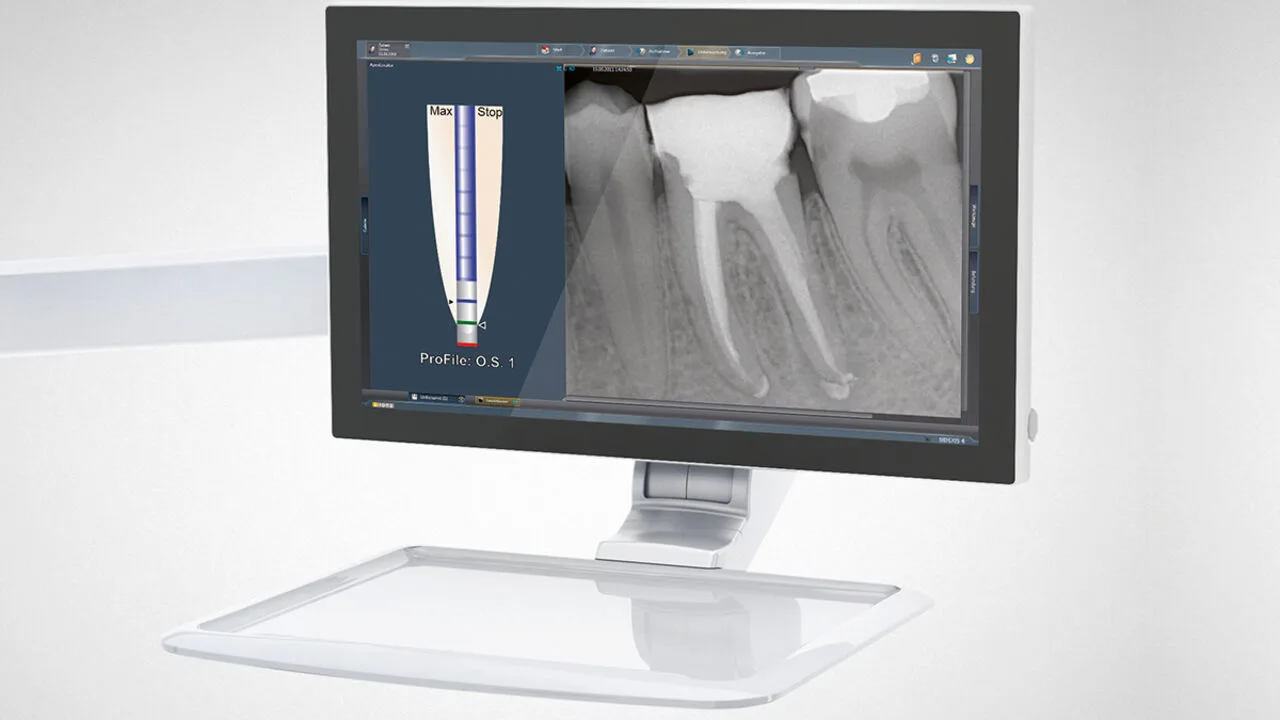 Monitor de la unidad Sinius con una radiografía de endodoncia