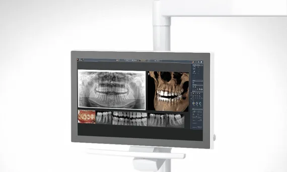 Radiografías de Sidexis 4 en el monitor de la unidad Sinius